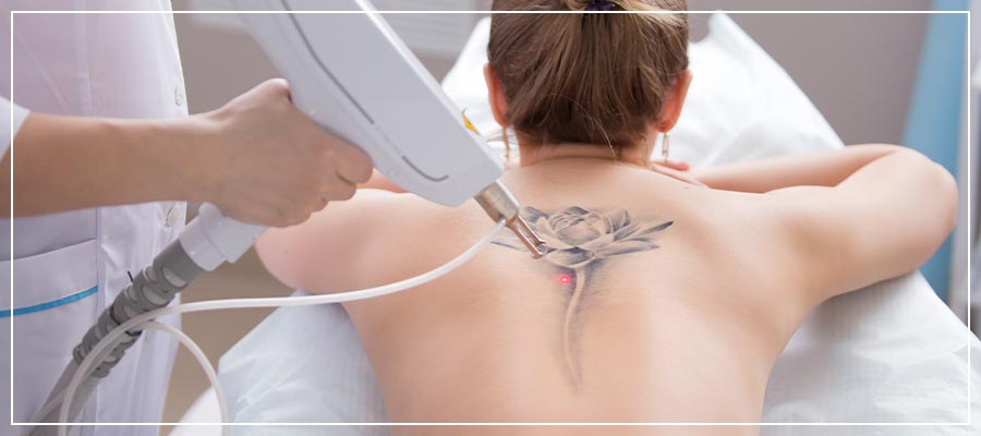 Laser Tattoo Removal Specialist in Orlando, FL Laser Tattoo Removal Specialist in Orlando, FL