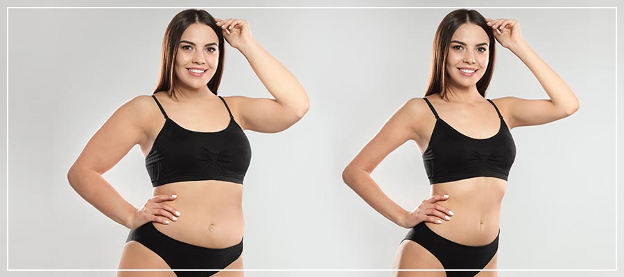 Semaglutide Medical Weight Loss Near Me in Orlando FL Semaglutide Medical Weight Loss Near Me in Orlando FL