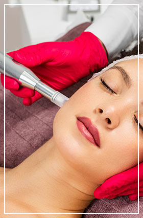 Microneedling  - Spa Blue Skin Care & Laser Center in Orlando, FL