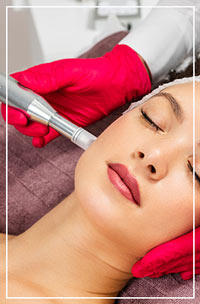 Microneedling  - Spa Blue Skin Care & Laser Center in Orlando, FL