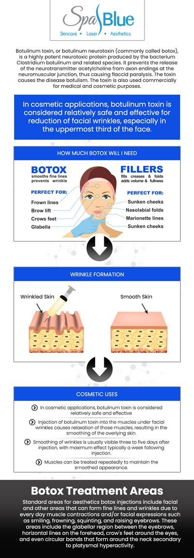 Botox is an FDA-approved cosmetic technique used to temporarily treat moderate-to-severe frown lines, wrinkles, and crow's feet, which cause creases between the eyebrows. The cost of Botox may differ slightly based on a variety of factors that can impact the treatment's total cost, like the areas and conditions being treated, the type of skin concern being addressed, and the number of units administered. At Spa Blue in Orlando, Janet Beres, PA-C, and her team of professionals offer Botox treatment. For more information, contact us today or schedule an appointment online. We are conveniently located at 7565 W Sand Lake Road, Orlando, FL 32819.