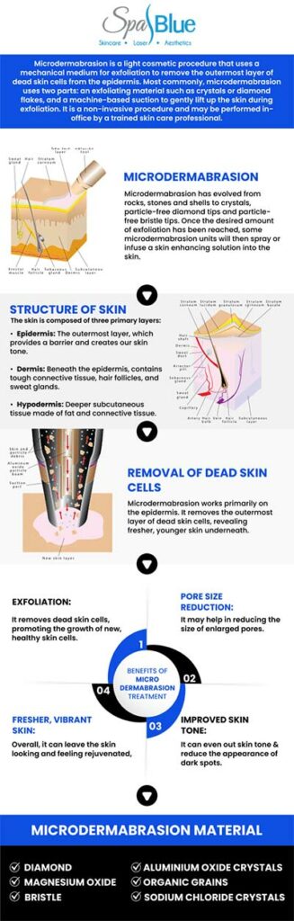 Microdermabrasion is a non-invasive skin care procedure. Microdermabrasion removes the skin's top layer. This can improve the texture and look of your skin, making it smoother and more youthful-looking. Microdermabrasion helps to minimize the appearance of age spots, enlarged pores, fine lines, wrinkles, acne scars, skin discoloration, uneven tone, stretch marks, and sun damage. Janet Beres, PA-C at Spa Blue, provides microdermabrasion. For more information, contact us today or request an appointment online. Our Med Spa is located at 7565 W Sand Lake Road, Orlando, FL 32819.