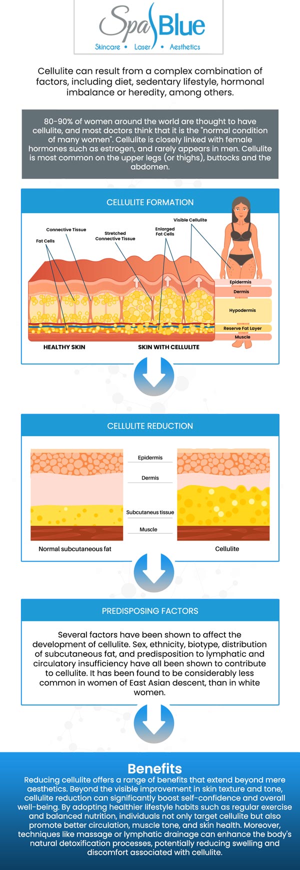 Janet Beres, PA-C, and her skilled team provide cellulite reduction treatment at Spa Blue Skin Care & Laser Center. With years of experience in dermatology and cosmetic treatments, she offers personalized, effective solutions to reduce the appearance of cellulite, helping you achieve smoother, firmer skin. For more information, contact us or schedule an appointment online. We are conveniently located at 7565 W Sand Lake Road, Orlando, FL 32819. Janet Beres, PA-C, and her skilled team provide cellulite reduction treatment at Spa Blue Skin Care & Laser Center. With years of experience in dermatology and cosmetic treatments, she offers personalized, effective solutions to reduce the appearance of cellulite, helping you achieve smoother, firmer skin. For more information, contact us or schedule an appointment online. We are conveniently located at 7565 W Sand Lake Road, Orlando, FL 32819.