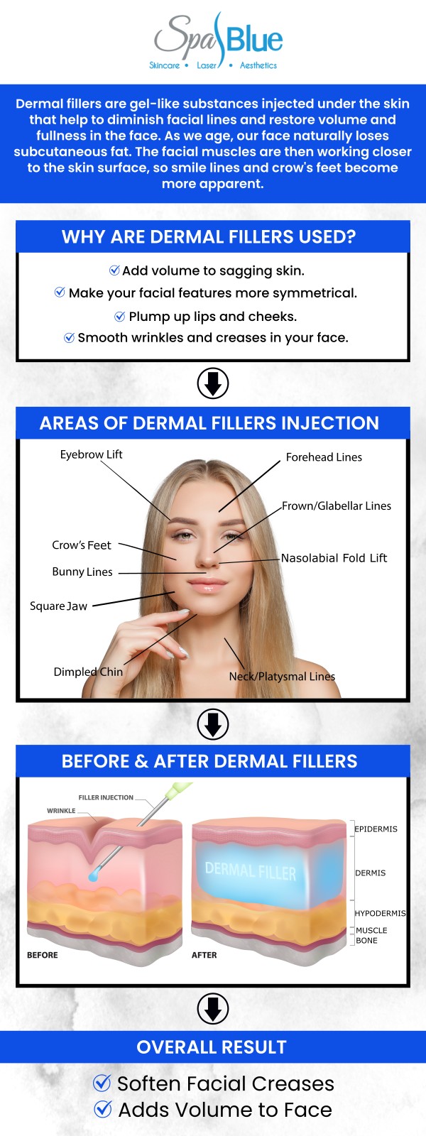 Explore the most trusted FDA approved dermal fillers for smoothing wrinkles, restoring volume, and enhancing facial contours. Learn about different types, their uses, and what to expect during treatment. Get trusted information to help you make informed cosmetic enhancement choices.For more information, contact us today or schedule an appointment online.