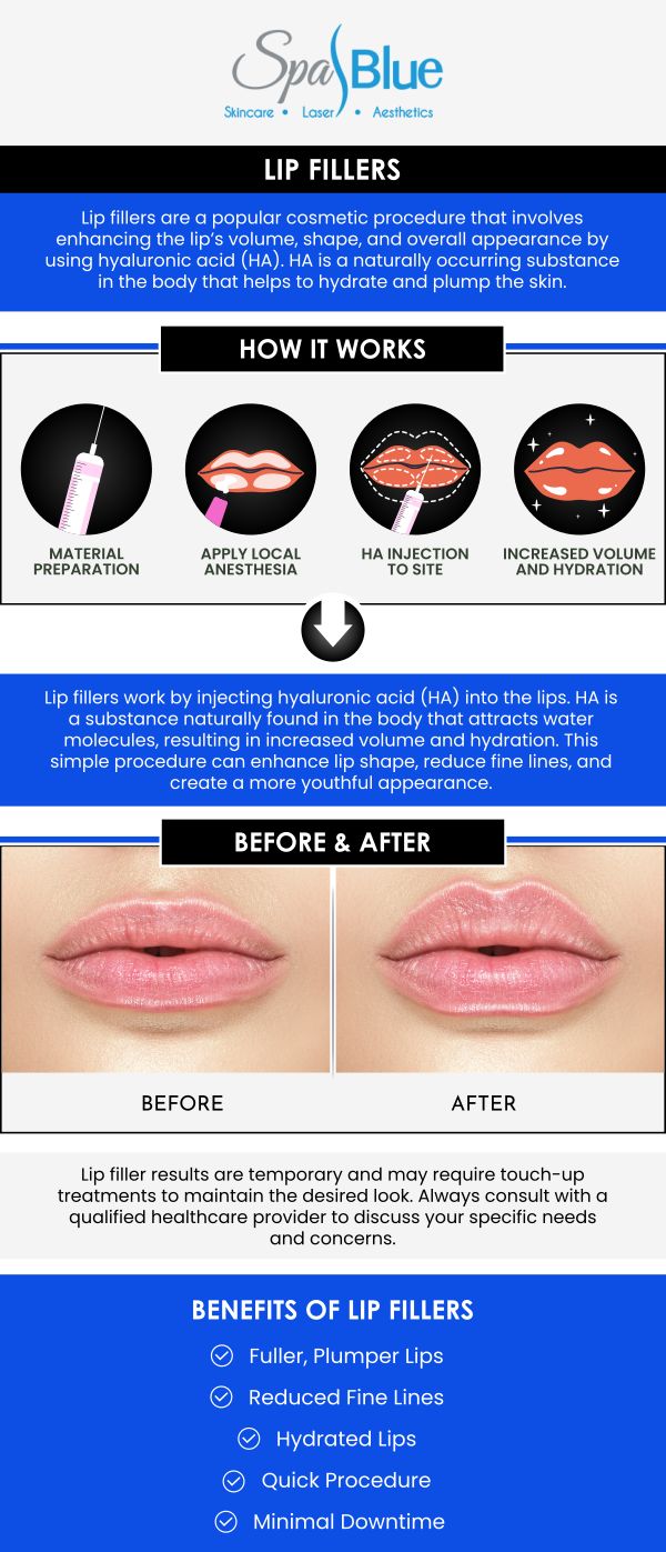 If you are looking for lip fillers near me, consider the best lip fillers offered at Spa Blue Skin Care & Laser Center. Janet Beres, PA-C, specializes in a variety of dermal fillers, including those for lip augmentation. With a focus on creating natural-looking results, she uses her extensive experience and artistic eye to ensure the treatment complements each patient's unique facial features. For more information, contact us or schedule an appointment online. We are located at 7565 W Sand Lake Road, Orlando, FL 32819.
