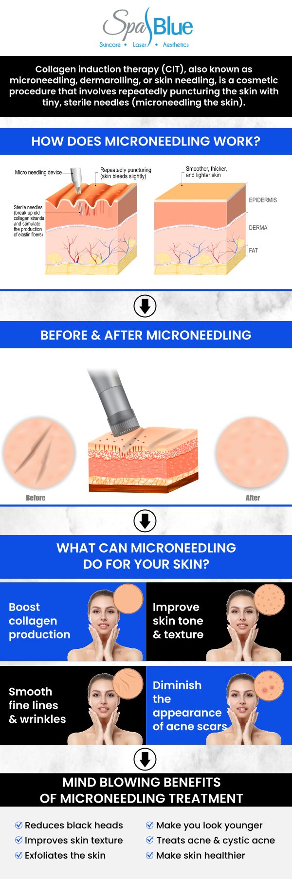 At Spa Blue Skin Care & Laser Center, Janet Beres, PA-C, and her team offer microneedling. The cost of a single microneedling session typically ranges from $200 to $700. Prices vary based on the additional treatments like serums or PRP (Platelet-Rich Plasma) are included. We offer package deals for multiple sessions, which can bring the per-session cost down. It's best to consult us for a precise quote based on your specific skin care needs. For more information, contact us or schedule an appointment online. We are located at 7565 W Sand Lake Road, Orlando, FL 32819.