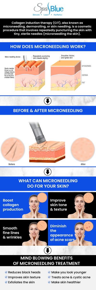 At Spa Blue Skin Care & Laser Center, Janet Beres, PA-C, and her team offer microneedling. The cost of a single microneedling session typically ranges from $200 to $700. Prices vary based on the additional treatments like serums or PRP (Platelet-Rich Plasma) are included. We offer package deals for multiple sessions, which can bring the per-session cost down. It's best to consult us for a precise quote based on your specific skin care needs. For more information, contact us or schedule an appointment online. We are located at 7565 W Sand Lake Road, Orlando, FL 32819.