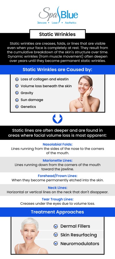 Static Wrinkles Can Make Skin Appear Tired or Aged Even When You Feel Your Best. Spa Blue Specializes in Advanced, Customized Treatments Led by Janet Beres, PA-C, to Smooth Lines and Restore Lost Volume. Static wrinkles can be treated effectively with options like Botox, alongside other customized treatments, to help you enjoy natural, balanced results. For more information, contact us or schedule an appointment online. We are conveniently located at 7565 W Sand Lake Road, Orlando, FL 32819. Static Wrinkles Can Make Skin Appear Tired or Aged Even When You Feel Your Best. Spa Blue Specializes in Advanced, Customized Treatments Led by Janet Beres, PA-C, to Smooth Lines and Restore Lost Volume. Static wrinkles can be treated effectively with options like Botox, alongside other customized treatments, to help you enjoy natural, balanced results. For more information, contact us or schedule an appointment online. We are conveniently located at 7565 W Sand Lake Road, Orlando, FL 32819.