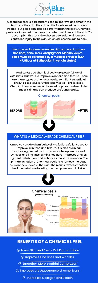 Before diving into the detailed treatment plan, it's essential to understand the science behind why chemical peels are so effective. As the specialist at Spa Blue, Janet Beres utilizes medical-grade solutions that are designed to break the acne cycle at its source. The process involves more than just surface exfoliation; it's a targeted, clinical destruction of bacteria and pigment. For more information, contact us or schedule an appointment online. We are conveniently located at 7565 W Sand Lake Road, Orlando, FL 32819.

Yes, chemical peels are one of the most effective, clinically proven treatments available for clearing active, stubborn acne and significantly reducing the appearance of persistent acne scars. The key to success is receiving medical-grade treatment and customization, which is the specialty of Janet Beres and the team at Spa Blue in Orlando, FL. We do not offer a one-size-fits-all solution; instead, we select the precise acid blend and strength necessary to target your specific skin concerns, whether it's deep cystic acne, blackheads, or pitted scarring.