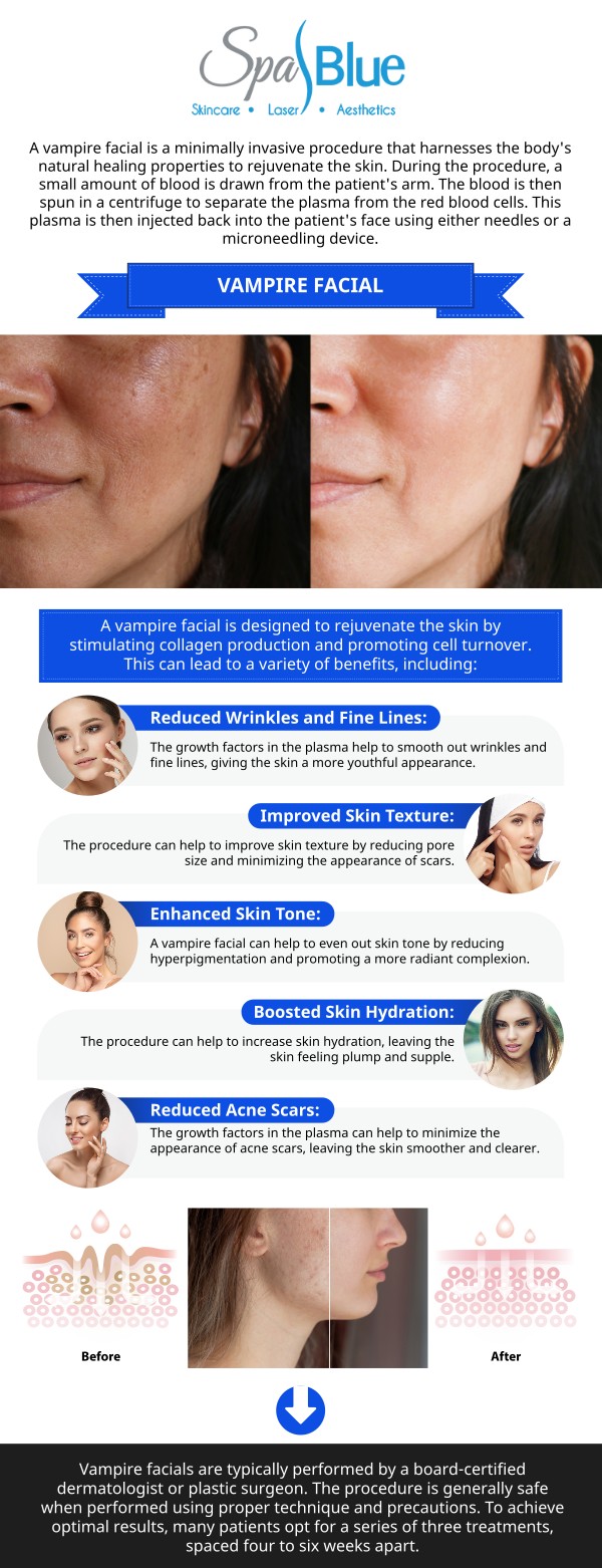 At Spa Blue Skin Care & Laser Center, we offer the revolutionary Vampire Facial® to help patients in Orlando achieve a radiant, youthful complexion. Administered by our advanced cosmetic injector, Janet Beres, PA-C—a certified trainer of Vampire treatments for the entire state of Florida—this innovative procedure combines microneedling with your body's natural platelet-rich plasma (PRP) to stimulate collagen production, reduce fine lines, and improve overall skin texture. With her extensive expertise and artistic eye, Janet and our team deliver exceptional, natural-looking results that beautifully revitalize your appearance. Contact Us Today or Request an Appointment Online. Our med spa is located at 7565 W Sand Lake Road, Orlando, FL 32819. At Spa Blue Skin Care & Laser Center, we offer the revolutionary Vampire Facial® to help patients in Orlando achieve a radiant, youthful complexion. Administered by our advanced cosmetic injector, Janet Beres, PA-C—a certified trainer of Vampire treatments for the entire state of Florida—this innovative procedure combines microneedling with your body's natural platelet-rich plasma (PRP) to stimulate collagen production, reduce fine lines, and improve overall skin texture. With her extensive expertise and artistic eye, Janet and our team deliver exceptional, natural-looking results that beautifully revitalize your appearance. Contact Us Today or Request an Appointment Online. Our med spa is located at 7565 W Sand Lake Road, Orlando, FL 32819.